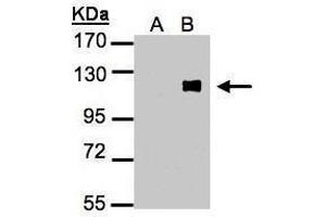 WB Image Western Blot analysis of ZNF281 expression in transfected 293T cell line by ZNF281 polyclonal antibody. (ZNF281 Antikörper)
