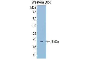 Western blot analysis of the recombinant protein. (LGALS9B Antikörper  (AA 228-355))