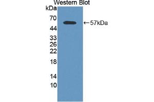 Detection of Recombinant CAPN2, Human using Polyclonal Antibody to Calpain 2 (CAPN2) (Calpain 2 Antikörper  (AA 45-514))