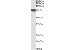 FOXP2 Antikörper  (C-Term)