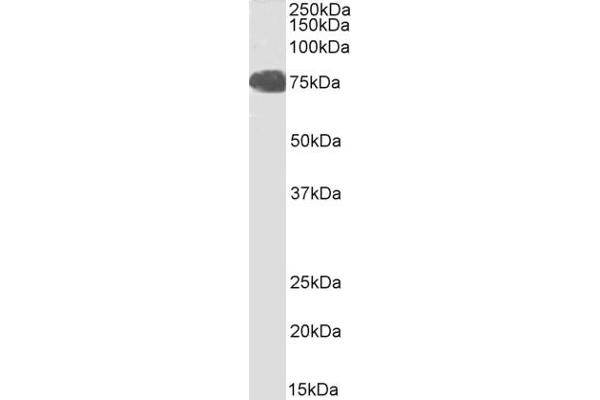 FOXP2 Antikörper  (C-Term)