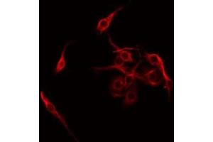 ABIN6275298 staining COLO205 by IF/ICC. (Neurexophilin 4 Antikörper  (Internal Region))