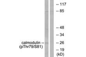 Western blot analysis of extracts from Jurkat cells treated with Insulin 0. (Calmodulin 1 Antikörper  (pThr79))