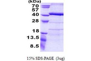 SDS-PAGE (SDS) image for Ankyrin Repeat Domain 54 (ANKRD54) (AA 1-300) protein (His tag) (ABIN6387201)