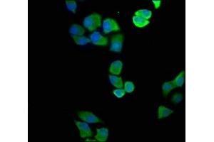 Immunofluorescence staining of Hela cells with ABIN7144595 at 1:100, counter-stained with DAPI. (ASL Antikörper  (AA 2-300))