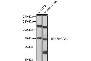 Western blot analysis of extracts of various cell lines, using RP/RP/RP antibody (ABIN3021243, ABIN3021244, ABIN3021245 and ABIN6214082) at 1:1000 dilution. (RPA1 Antikörper  (AA 367-616))