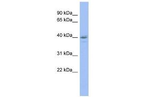 HDAC11 antibody used at 1 ug/ml to detect target protein. (HDAC11 Antikörper  (Middle Region))
