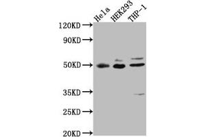 Western Blot Positive WB detected in: Hela whole cell lysate, HEK293 whole cell lysate, THP-1 whole cell lysate All lanes: MAPKAPK2 antibody at 1:1000 Secondary Goat polyclonal to rabbit IgG at 1/50000 dilution Predicted band size: 46, 43 kDa Observed band size: 49 kDa