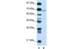 WB Suggested Anti-ZBTB22 Antibody Titration:  0.