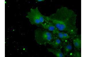 Anti-POR mouse monoclonal antibody (ABIN2453490) immunofluorescent staining of COS7 cells transiently transfected by pCMV6-ENTRY POR (RC202172). (POR Antikörper)