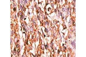 Immunohistochemistry (IHC) image for anti-VEGF Receptor 2 (VEGFR2) (pTyr996) antibody (ABIN3028780)