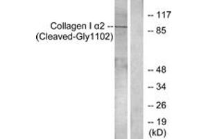 Western blot analysis of extracts from Jurkat cells, treated with etoposide 25uM 24h, using Collagen I alpha2 (Cleaved-Gly1102) Antibody. (COL1A2 Antikörper  (Cleaved-Gly1102))