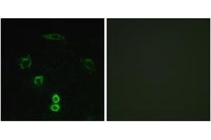 Immunofluorescence analysis of A549 cells, using GLCTK Antibody. (GLYCTK Antikörper  (AA 101-150))