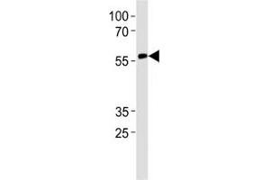 Western Blotting (WB) image for anti-Runt-Related Transcription Factor 2 (RUNX2) (AA 445-474) antibody (ABIN3032500)