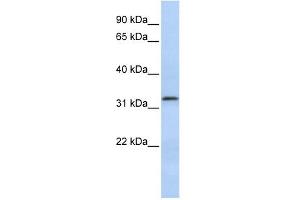 Beta Lactamase 2 antibody used at 1 ug/ml to detect target protein. (LACTB2 Antikörper  (Middle Region))