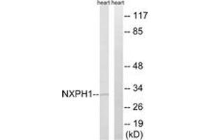 Western blot analysis of extracts from rat heart cells, using NXPH1 Antibody.