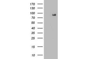 Western Blotting (WB) image for anti-Fibroblast Growth Factor Receptor 2 (FGFR2) antibody (ABIN1498249) (FGFR2 Antikörper)