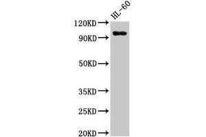 Western Blot Positive WB detected in: HL60 whole cell lysate All lanes: KMT5B antibody at 3 μg/mL Secondary Goat polyclonal to rabbit IgG at 1/50000 dilution Predicted band size: 100, 45, 32 kDa Observed band size: 100 kDa (SUV420H1 Antikörper  (AA 100-150))