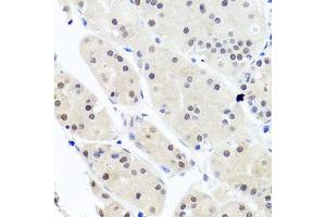 Immunohistochemistry of paraffin-embedded human stomach using HNRNPCL1 antibody (ABIN5995850) at dilution of 1/100 (40x lens). (HNRNPCL1 Antikörper)