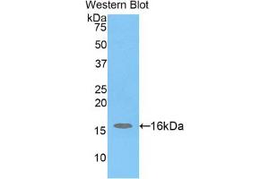 Western blot analysis of the recombinant protein. (H2AFJ Antikörper  (AA 3-129))