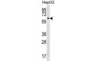 Western Blotting (WB) image for anti-CDC14 Cell Division Cycle 14 Homolog A (CDC14A) antibody (ABIN3003762) (CDC14A Antikörper)