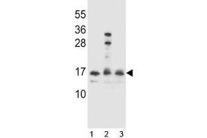 HOPX antibody western blot analysis in 1) Ramos, 2) A2058 and 3) 293 lysate. (HOPX Antikörper  (AA 39-67))