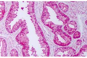 Anti-FKBP52 antibody IHC staining of human prostate. (FKBP4 Antikörper)