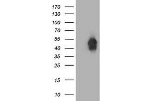 HEK293T cells were transfected with the pCMV6-ENTRY control (Left lane) or pCMV6-ENTRY BECN1 (Right lane) cDNA for 48 hrs and lysed. (Beclin 1 Antikörper)