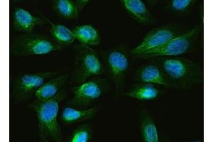 IF analysis of ARL13B using anti-ARL13B antibody (ABIN7600179). (ARL13B Antikörper  (AA 16-428))