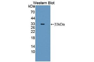 Western blot analysis of the recombinant protein. (MMP20 Antikörper  (AA 137-398))