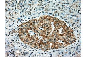 Immunohistochemical staining of paraffin-embedded Kidney tissue using anti-TYRO3mouse monoclonal antibody. (TYRO3 Antikörper)