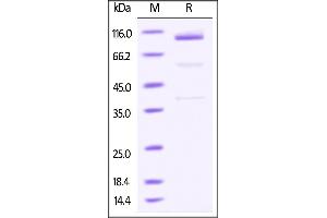 Mouse Glypican 3 / GPC3, Fc Tag on SDS-PAGE under reducing (R) condition. (Glypican 3 Protein (GPC3) (AA 25-557) (Fc Tag))