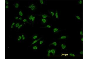 Immunofluorescence of monoclonal antibody to TRIM24 on HeLa cell. (TRIM24 Antikörper  (AA 432-569))