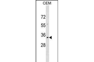 NKX2-6 Antibody (N-term) (ABIN1539020 and ABIN2849720) western blot analysis in CEM cell line lysates (35 μg/lane). (NKX2-6 Antikörper  (N-Term))