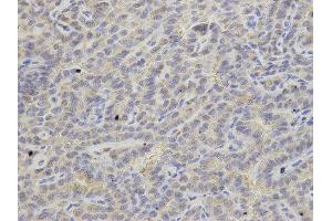Immunohistochemistry (IHC) image for anti-Adenine Phosphoribosyltransferase (APRT) antibody (ABIN1876644) (APRT Antikörper)