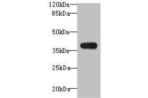 Western blot All lanes: ASB7 antibody at 8 μg/mL + A431 whole cell lysate Secondary Goat polyclonal to rabbit IgG at 1/10000 dilution Predicted band size: 37, 31 kDa Observed band size: 37 kDa