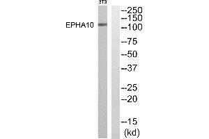 Western blot analysis of extracts from NIH-3T3 cells, using EPHA10 antibody. (EPH Receptor A10 Antikörper  (Internal Region))
