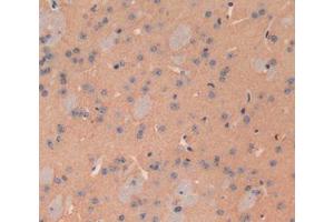 Used in DAB staining on fromalin fixed paraffin- embedded brain tissue (ATP2B2 Antikörper  (AA 417-830))