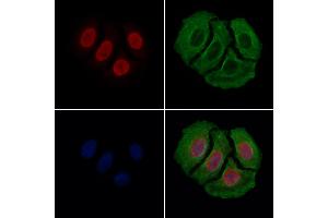 ABIN6262334 and ABIN6279483 staining Hela cells by IF/ICC.