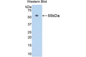 Western Blotting (WB) image for anti-Angiotensinogen (serpin Peptidase Inhibitor, Clade A, Member 8) (AGT) (AA 25-477) antibody (ABIN1173620) (AGT Antikörper  (AA 25-477))