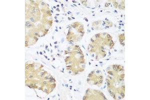 Immunohistochemistry of paraffin-embedded human stomach using TRH antibody at dilution of 1:100 (40x lens). (TRH Antikörper)