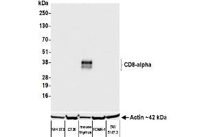 Western Blotting (WB) image for anti-CD8a Molecule (CD8A) (AA 28-194) antibody (ABIN7453877)