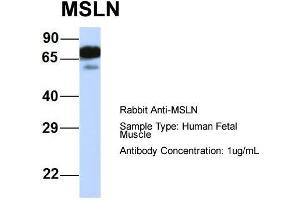 Host:  Rabbit  Target Name:  MSLN  Sample Type:  Human Fetal Muscle  Antibody Dilution:  1. (Mesothelin Antikörper  (Middle Region))