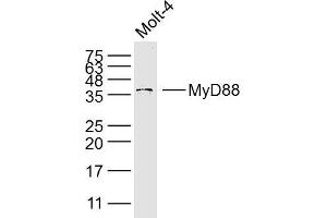 Image no. 3 for anti-Myeloid Differentiation Primary Response Gene (88) (MYD88) (AA 201-296) antibody (ABIN736881)