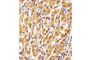 Immunohistochemical analysis of paraffin-embedded H. (GAPDH Antikörper)