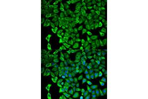 Immunofluorescence analysis of HeLa cells using PSMD2 antibody. (PSMD2 Antikörper)