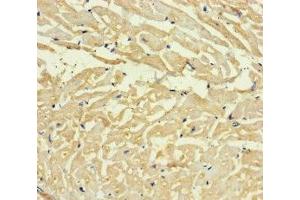 Immunohistochemistry of paraffin-embedded human heart tissue using ABIN7167666 at dilution of 1:100