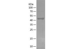 Western Blotting (WB) image for Forkhead Box O3 (FOXO3) (AA 478-673) protein (His-IF2DI Tag) (ABIN7122994) (FOXO3 Protein (AA 478-673) (His-IF2DI Tag))
