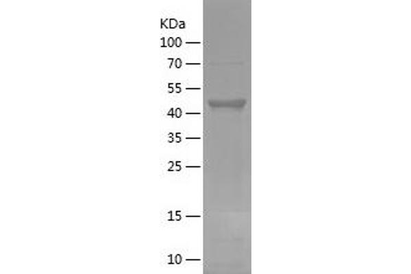 FOXO3 Protein (AA 478-673) (His-IF2DI Tag)