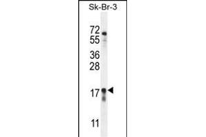 C Antibody (Center) (ABIN655473 and ABIN2844997) western blot analysis in SK-BR-3 cell line lysates (35 μg/lane). (C1ORF115 Antikörper  (AA 76-104))